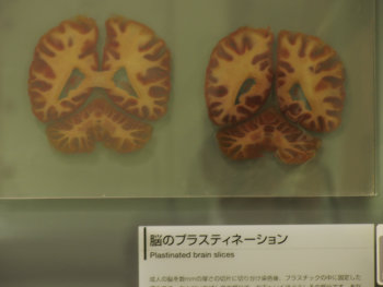 Human brain slice